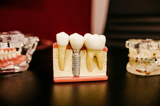 Biomimetic Dentistry: Keeping More of Your Natural Tooth