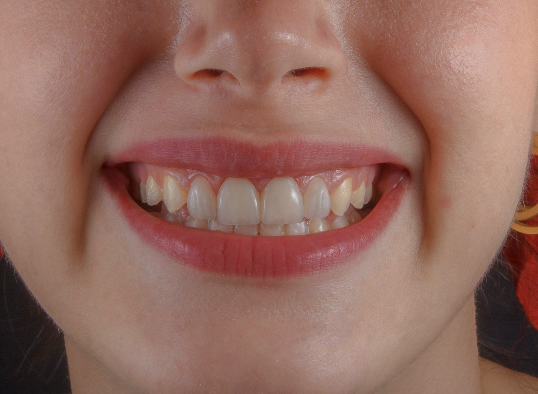 Remineralizing Teeth Naturally: A Daily Routine That Actually Sticks