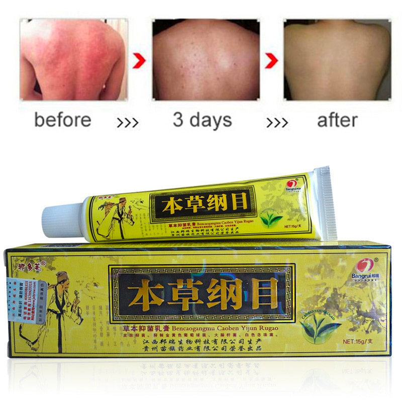 Anti Itch Cream Before After Days