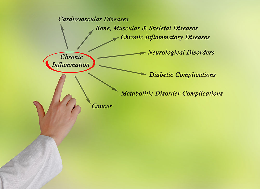 Doctor Pointing Chronic Inflammation Outcomes