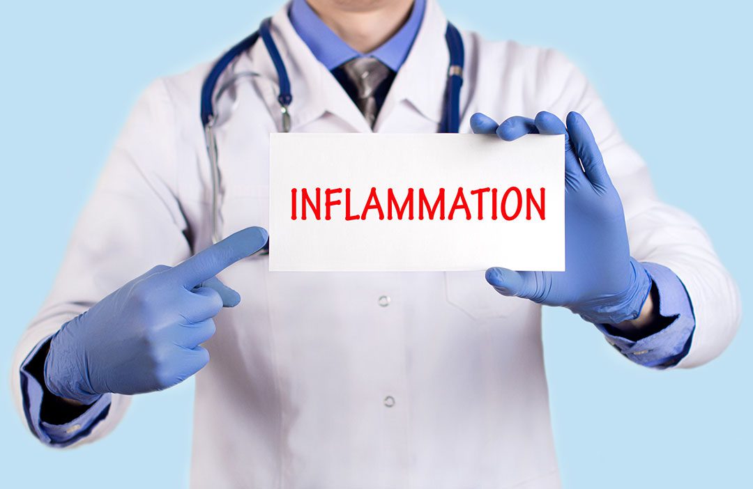 Doctor Showing Inflammation